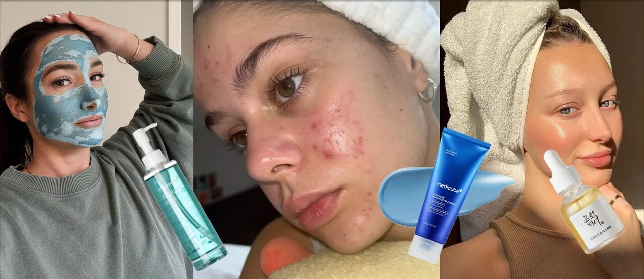 TOP Korejská kosmetika na akné a mastnou pleť: Jak pečovat o pleť, aby byla čistá, hydratovaná a bez mastného lesku