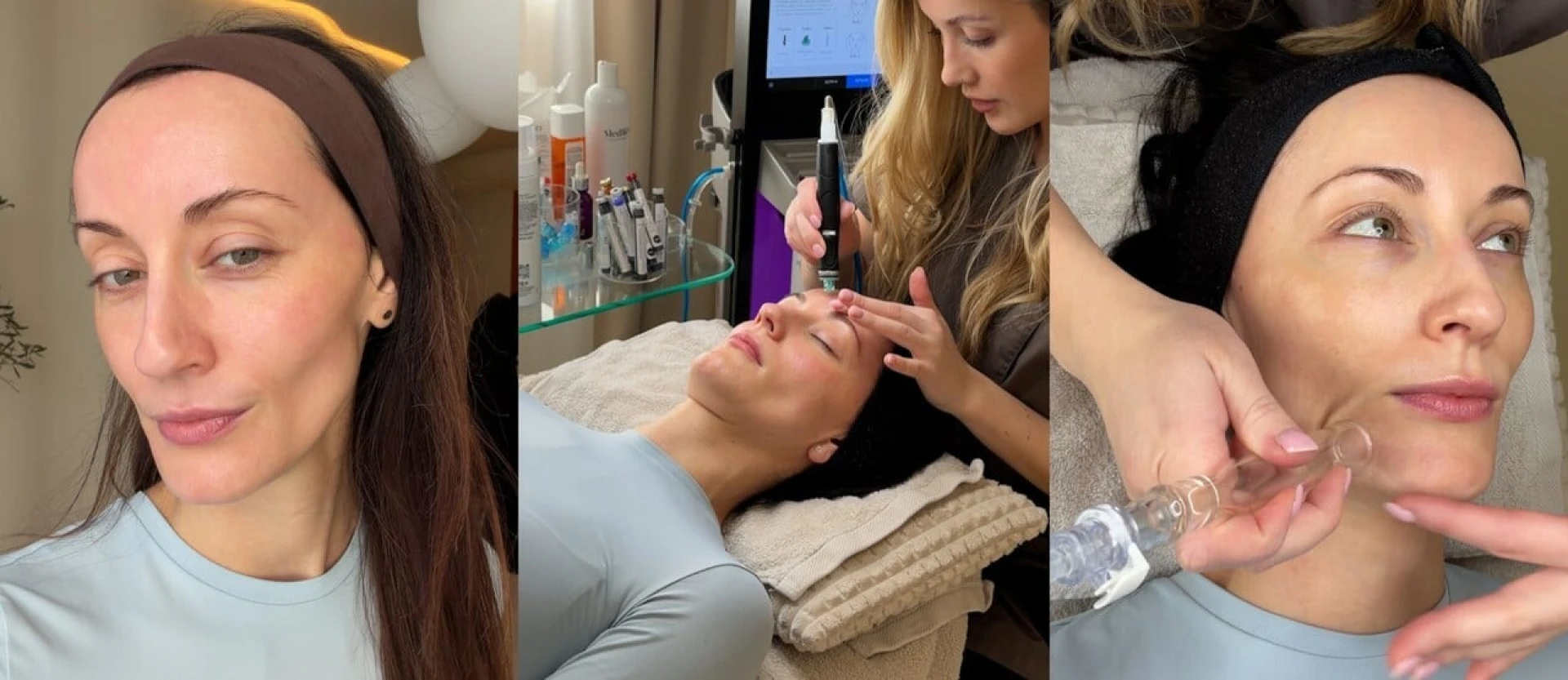 Vyzkoušela jsem HydraFacial: Tohle ošetření ti pleť doslova „vysaje“ do dokonalosti